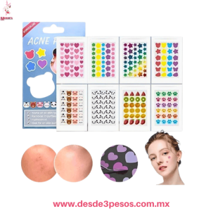 Planilla con 36 Pegatinas para Cubrir Espinillas y Granos, en Figuras como foto H097-3